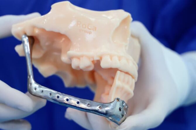 Hito Quirúrgico en Clínicas Colina: Exitosa Reconstrucción Mandibular de Alta Complejidad con Prótesis Personalizada 1 WhatsApp Image 2026 09 30 at 9.45.46 AM